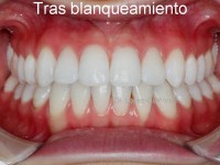 091-oroto y blanq final con aguas